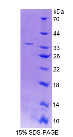 羧酸酯酶1(CES1)重組蛋白,Recombinant Carboxylesterase 1 (CES1)