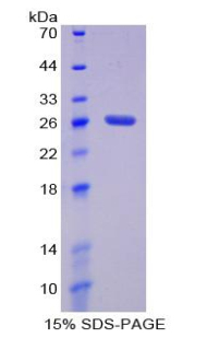 損傷特異性DNA結(jié)合蛋白2(DDB2)重組蛋白,Recombinant Damage Specific DNA Binding Protein 2 (DDB2)