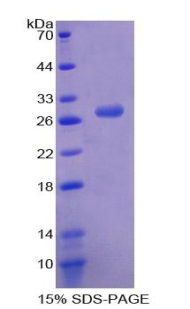 髓细胞核分化抗原(MNDA)重组蛋白,Recombinant Myeloid Cell Nuclear Differentiation Antigen (MNDA)