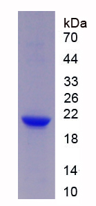 髓细胞触发受体2(TREM2)重组蛋白,Recombinant Triggering Receptor Expressed On Myeloid Cells 2 (TREM2)