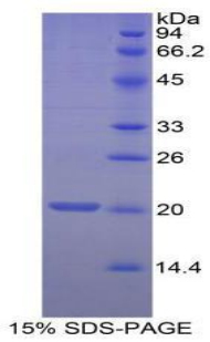 髓鞘少突胶质细胞糖蛋白(MOG)重组蛋白,Recombinant Myelin Oligodendrocyte Glycoprotein (MOG)