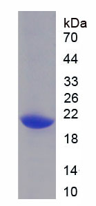 酸性核磷蛋白32A(ANP32A)重组蛋白,Recombinant Acidic Nuclear Phosphoprotein 32 Family, Member A (ANP32A)