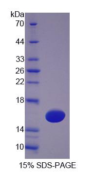 四旋蛋白1(TSPAN1)重組蛋白,Recombinant Tetraspanin 1 (TSPAN1)