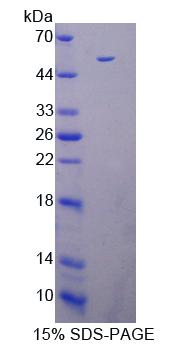 死亡關(guān)聯(lián)蛋白激酶3(DAPK3)重組蛋白,Recombinant Death Associated Protein Kinase 3 (DAPK3)