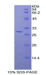 斯鈣素2(STC2)重組蛋白,Recombinant Stanniocalcin 2 (STC2)