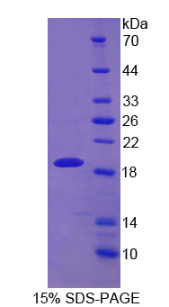 絲織蛋白1(DBN1)重組蛋白,Recombinant Drebrin 1 (DBN1)