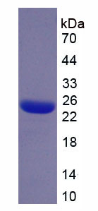 絲束蛋白3(PLS3)重組蛋白,Recombinant Plastin 3 (PLS3)