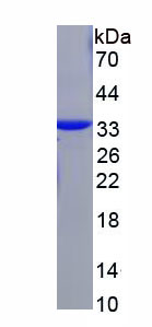 丝束蛋白1(PLS1)重组蛋白,Recombinant Plastin 1 (PLS1)