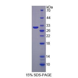 糖蛋白A33(GPA33)重组蛋白