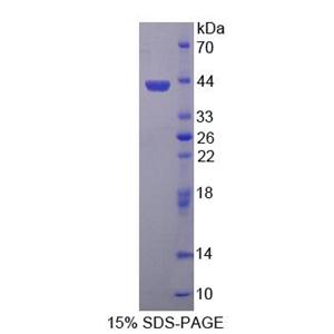 羰基还原酶3(CBR3)重组蛋白,Recombinant Carbonyl Reductase 3 (CBR3)