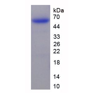 肽酶抑制因子16(PI16)重组蛋白