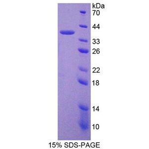 肽基精氨酸脱亚氨酶Ⅵ(PADI6)重组蛋白