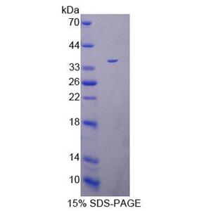 肽基精氨酸脱亚氨酶Ⅳ(PADI4)重组蛋白