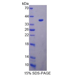 肽基精氨酸脱亚氨酶Ⅲ(PADI3)重组蛋白,Recombinant Peptidyl Arginine Deiminase Type III (PADI3)