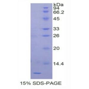 胎盘特异性蛋白9(PLAC9)重组蛋白