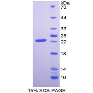 胎盘泌乳素(PL)重组蛋白,Recombinant Placental Lactogen (PL)