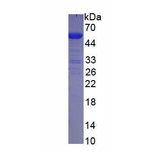 胎盘碱性磷酸酶(ALPP)重组蛋白,Recombinant Alkaline Phosphatase, Placental (ALPP)