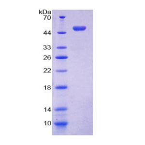胎盘蛋白13(PP13)重组蛋白