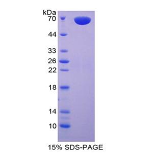 羧肽酶A3(CPA3)重组蛋白