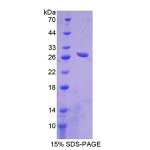 羧肽酶A1(CPA1)重组蛋白