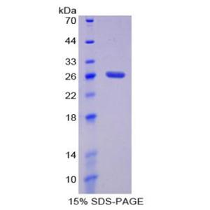 损伤特异性DNA结合蛋白2(DDB2)重组蛋白