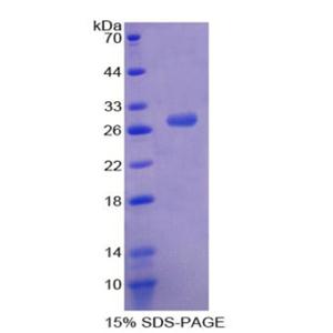 髓细胞核分化抗原(MNDA)重组蛋白,Recombinant Myeloid Cell Nuclear Differentiation Antigen (MNDA)