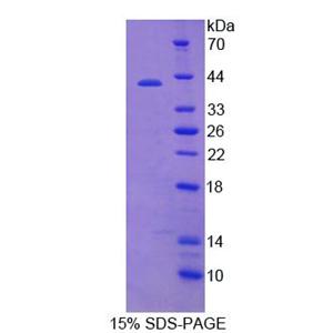 酸性唾液脯氨酸豐富磷蛋白2(PRH2)重組蛋白,Recombinant Acidic Salivary Proline Rich Phosphoprotein 2 (PRH2)