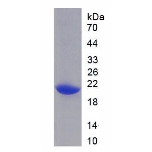 酸性核磷蛋白32A(ANP32A)重组蛋白