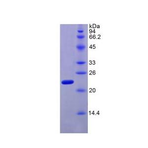 松弛肽2(RLN2)重组蛋白