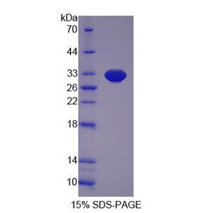 死亡诱导终结因子1(DIDO1)重组蛋白