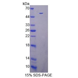 死亡关联蛋白激酶3(DAPK3)重组蛋白