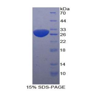 死骨片1(SQSTM1)重组蛋白