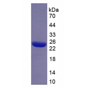 丝束蛋白3(PLS3)重组蛋白
