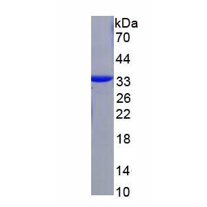 丝束蛋白1(PLS1)重组蛋白