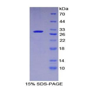 丝裂原激活蛋白激酶激酶激酶激酶5(MAP4K5)重组蛋白