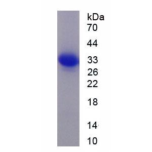 丝裂原激活蛋白激酶激酶激酶7相互作用蛋白1(MAP3K7IP1)重组蛋白,Recombinant Mitogen Activated Protein Kinase Kinase Kinase 7 Interacting Protein 1 (MAP3K7IP1)