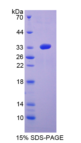 絲裂原激活蛋白激酶激酶6(MAP2K6)重組蛋白,Recombinant Mitogen Activated Protein Kinase Kinase 6 (MAP2K6)