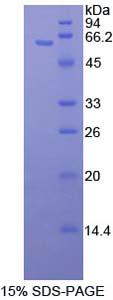 絲裂原激活蛋白激酶激酶4(MAP2K4)重組蛋白,Recombinant Mitogen Activated Protein Kinase Kinase 4 (MAP2K4)