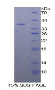 絲裂原激活蛋白激酶激酶1(MAP2K1)重組蛋白,Recombinant Mitogen Activated Protein Kinase Kinase 1 (MAP2K1)