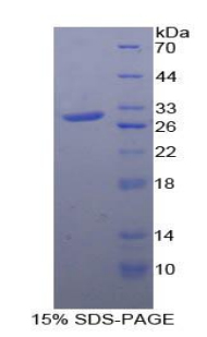 絲裂原激活蛋白激酶激活蛋白激酶2(MAPKAPK2)重組蛋白,Recombinant MAP Kinase Activated Protein Kinase 2 (MAPKAPK2)