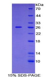 絲蛋白Cγ(FLNC)重組蛋白,Recombinant Filamin C Gamma (FLNC)