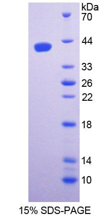 絲氨酸棕櫚酰轉(zhuǎn)移酶長(zhǎng)鏈堿性亞基1(SPTLC1)重組蛋白,Recombinant Serine Palmitoyltransferase, Long Chain Base Subunit 1 (SPTLC1)