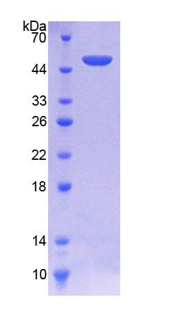 丝氨酸肽酶抑制因子Kunitz型2(SPINT2)重组蛋白,Recombinant Serine Peptidase Inhibitor Kunitz Type 2 (SPINT2)