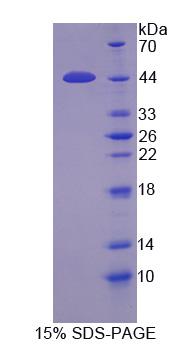 丝氨酸蛋白酶23(PRSS23)重组蛋白,Recombinant Protease, Serine 23 (PRSS23)