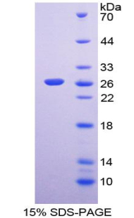 丝氨酸蛋白酶2(PRSS2)重组蛋白,Recombinant Protease, Serine 2 (PRSS2)