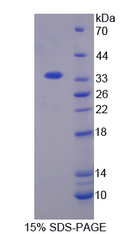 丝氨酸/苏氨酸激酶3(STK3)重组蛋白,Recombinant Serine/Threonine Kinase 3 (STK3)