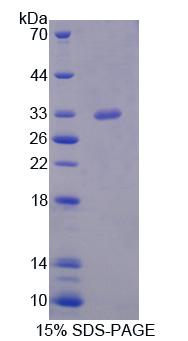 絲氨酸/蘇氨酸激酶11(STK11)重組蛋白,Recombinant Serine/Threonine Kinase 11 (STK11)