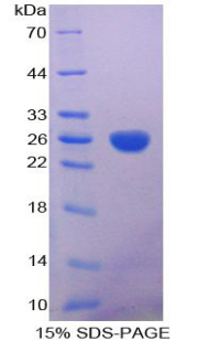 順烏頭酸酶1(ACO1)重組蛋白,Recombinant Aconitase 1 (ACO1)