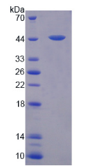 水通道蛋白4(AQP4)重组蛋白,Recombinant Aquaporin 4 (AQP4)