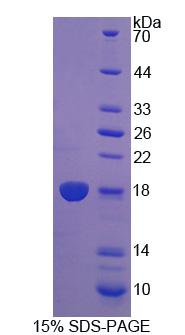 双特异性磷酸酶5(DUSP5)重组蛋白,Recombinant Dual Specificity Phosphatase 5 (DUSP5)